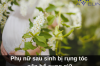 Phụ nữ sau sinh bị rụng tóc nên bổ sung gì?