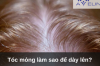 Tóc mỏng làm sao để dày lên?